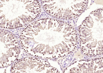 HMGB4 Rabbit Polyclonal Antibody