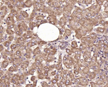 Hrasls3 Rabbit Polyclonal Antibody