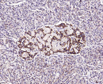 Hrasls3 Rabbit Polyclonal Antibody