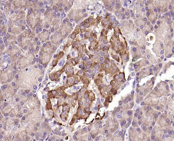 Hrasls3 Rabbit Polyclonal Antibody