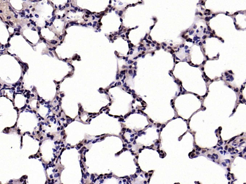 Phospho-IKB alpha (Ser32 + Ser36) Rabbit Polyclonal Antibody