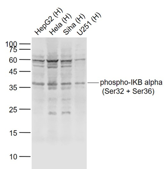 Phospho-IKB alpha (Ser32 + Ser36) Rabbit Polyclonal Antibody