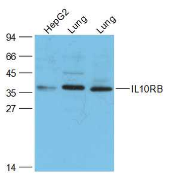 IL10RB Rabbit Polyclonal Antibody