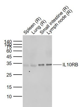 IL10RB Rabbit Polyclonal Antibody