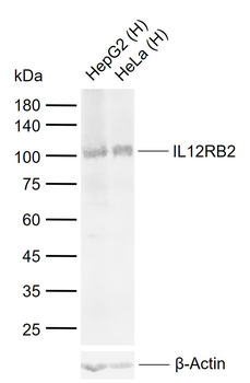 IL12RB2 Rabbit Polyclonal Antibody