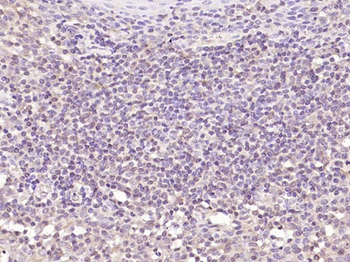 IL15RA Rabbit Polyclonal Antibody