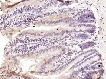 IL15RA Rabbit Polyclonal Antibody