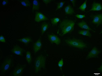 IL-15 Rabbit Polyclonal Antibody