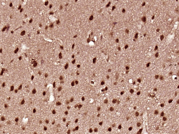 IL-16 Rabbit Polyclonal Antibody