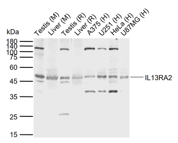 IL13RA2 Rabbit Polyclonal Antibody