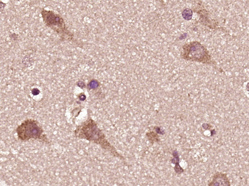 Hexokinase II Rabbit Polyclonal Antibody