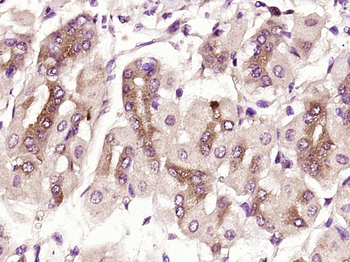 Hexokinase II Rabbit Polyclonal Antibody