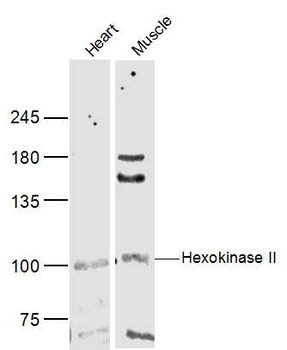 Hexokinase II Rabbit Polyclonal Antibody