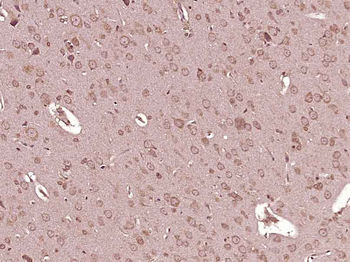 IL-6R alpha Rabbit Polyclonal Antibody