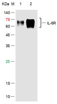 IL-6R alpha Rabbit Polyclonal Antibody