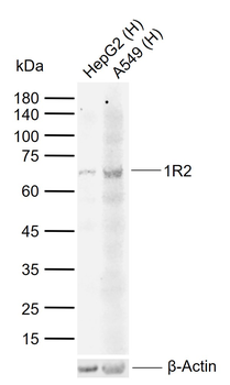 IL-1R2 Rabbit Polyclonal Antibody