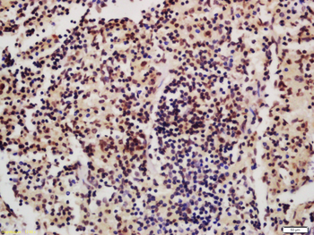 IRF4 Rabbit Polyclonal Antibody