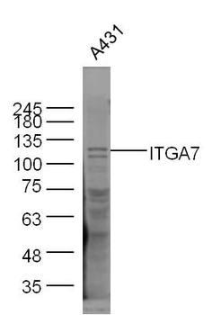ITGA7 Rabbit Polyclonal Antibody