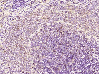 Phospho-JAK2 (Tyr1007+Tyr1008) Rabbit Polyclonal Antibody