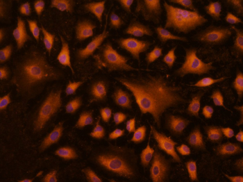 Phospho-JAK2 (Tyr1007+Tyr1008) Rabbit Polyclonal Antibody