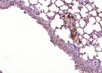 Phospho-JAK2 (Tyr1007+Tyr1008) Rabbit Polyclonal Antibody