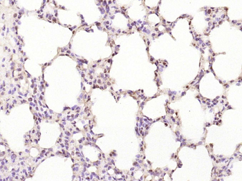 Phospho-JAK2 (Tyr1007+Tyr1008) Rabbit Polyclonal Antibody