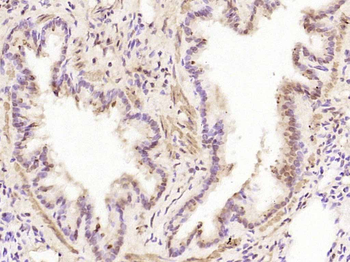 Phospho-JAK2 (Tyr1007+Tyr1008) Rabbit Polyclonal Antibody