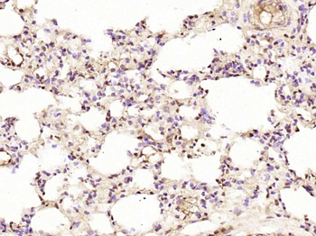 Phospho-JAK2 (Tyr1007+Tyr1008) Rabbit Polyclonal Antibody