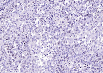 Ki-67 Rabbit Polyclonal Antibody