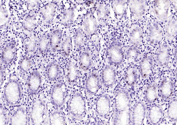 Ki-67 Rabbit Polyclonal Antibody