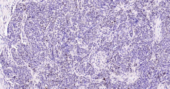 Ki-67 Rabbit Polyclonal Antibody