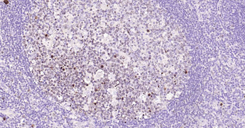 Ki-67 Rabbit Polyclonal Antibody