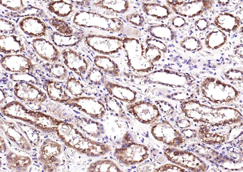 KLK1 Rabbit Polyclonal Antibody
