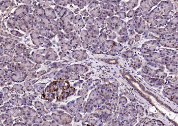 KLK1 Rabbit Polyclonal Antibody