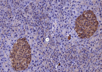 KLK1 Rabbit Polyclonal Antibody