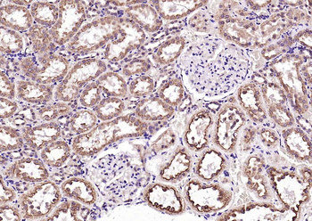 KLK1 Rabbit Polyclonal Antibody