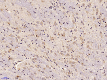 KLK7 Rabbit Polyclonal Antibody