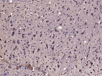 KLK7 Rabbit Polyclonal Antibody