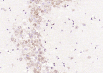LCAT Rabbit Polyclonal Antibody