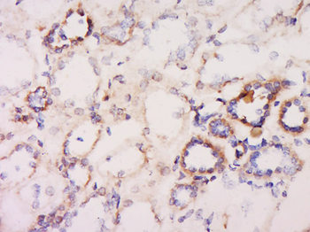 LDHA Rabbit Polyclonal Antibody