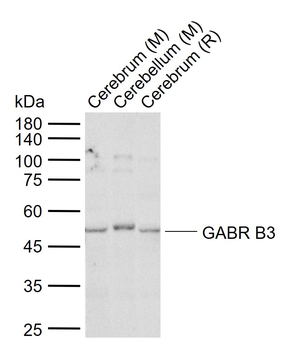 GABR B3 Rabbit Polyclonal Antibody