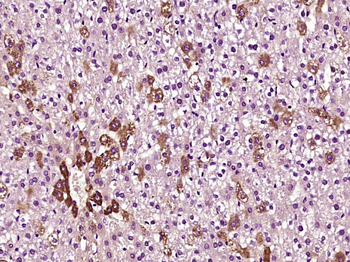 Lipoprotein lipase Rabbit Polyclonal Antibody