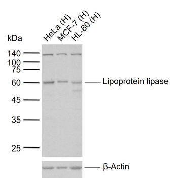 Lipoprotein lipase Rabbit Polyclonal Antibody