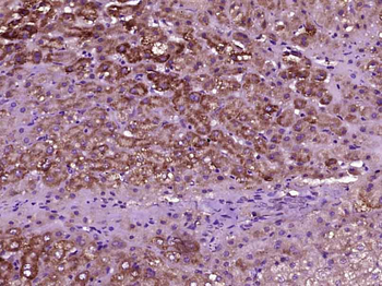 MASP2 Rabbit Polyclonal Antibody