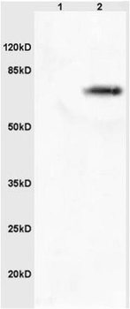 MASP2 Rabbit Polyclonal Antibody