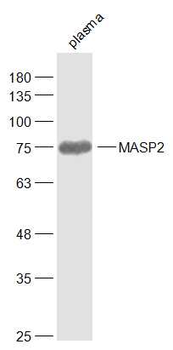 MASP2 Rabbit Polyclonal Antibody