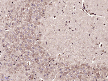 MCP3 Rabbit Polyclonal Antibody