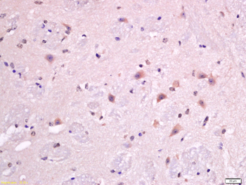 Macrophage Inflammatory Protein 1 gamma Rabbit Polyclonal Antibody