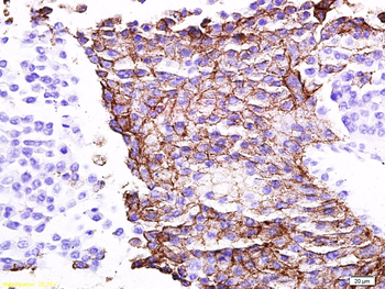 CCL18 Rabbit Polyclonal Antibody