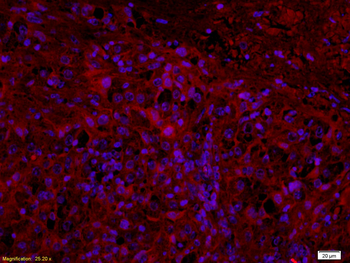 CCL18 Rabbit Polyclonal Antibody